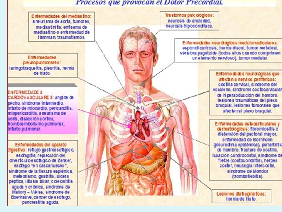 El pecho de silicio anny hilkevich